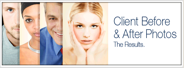 Client results. Before and after photos.